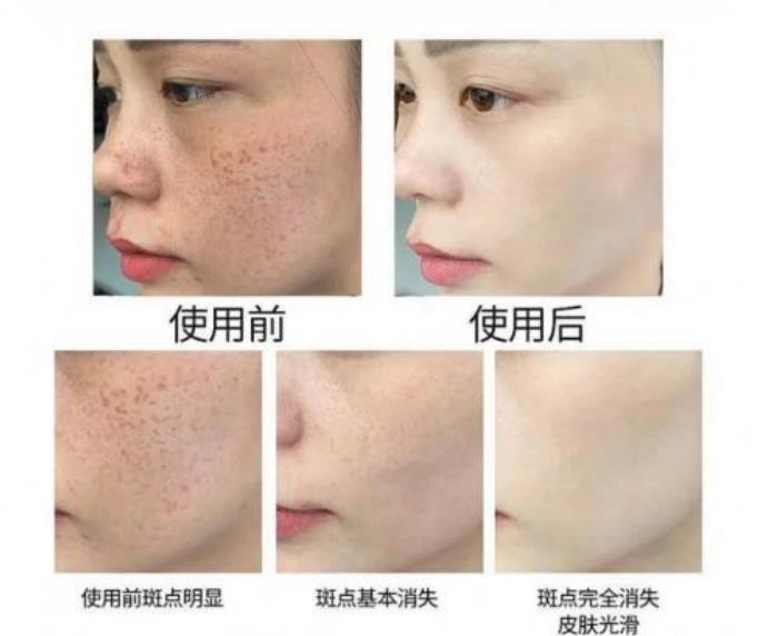 <strong>祛斑功效型化妆品制造OEM代加工</strong>