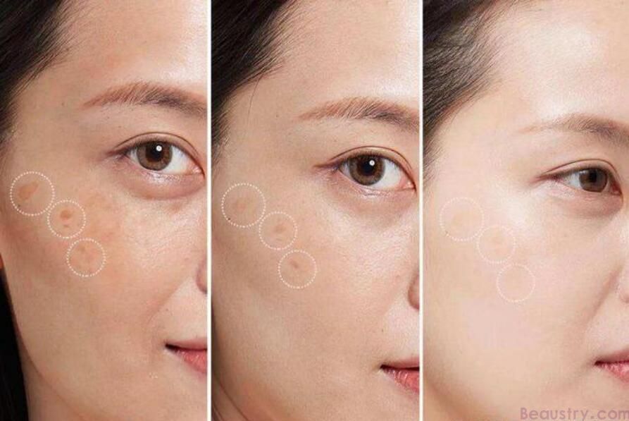 美白淡斑，成为女性美容领域永恒的话题。